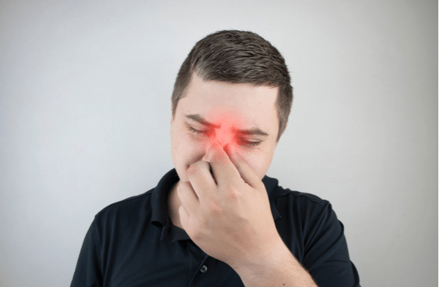 Nasal bridge pain headache.
