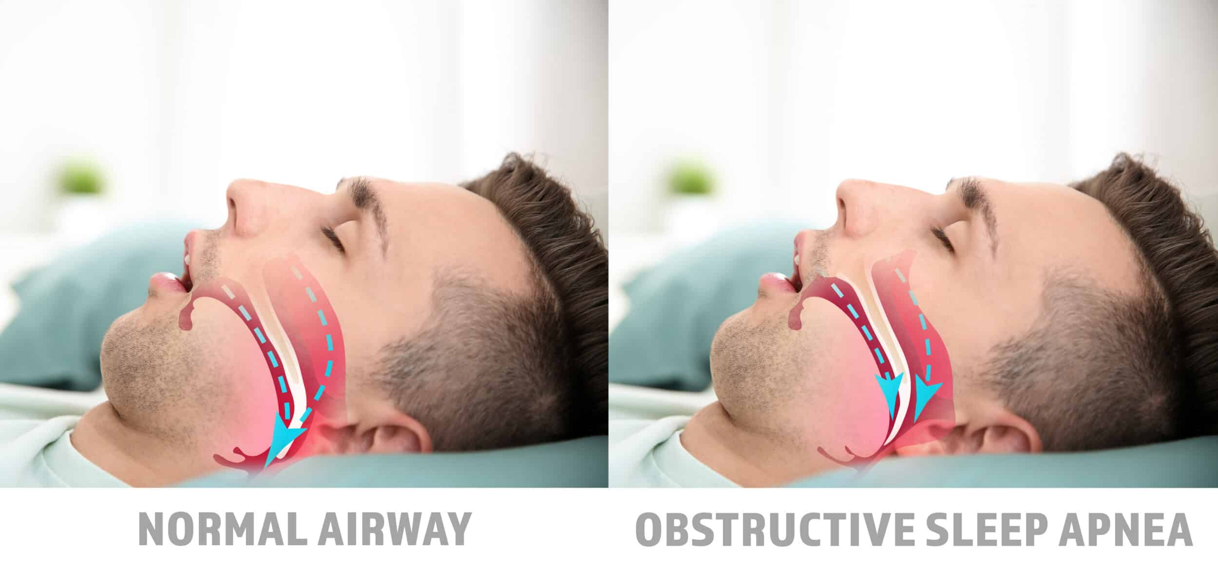 Sleep Apnea & Snoring Treatment Las Vegas NV Sleep Apnea & Snoring Treatment Las Vegas NV