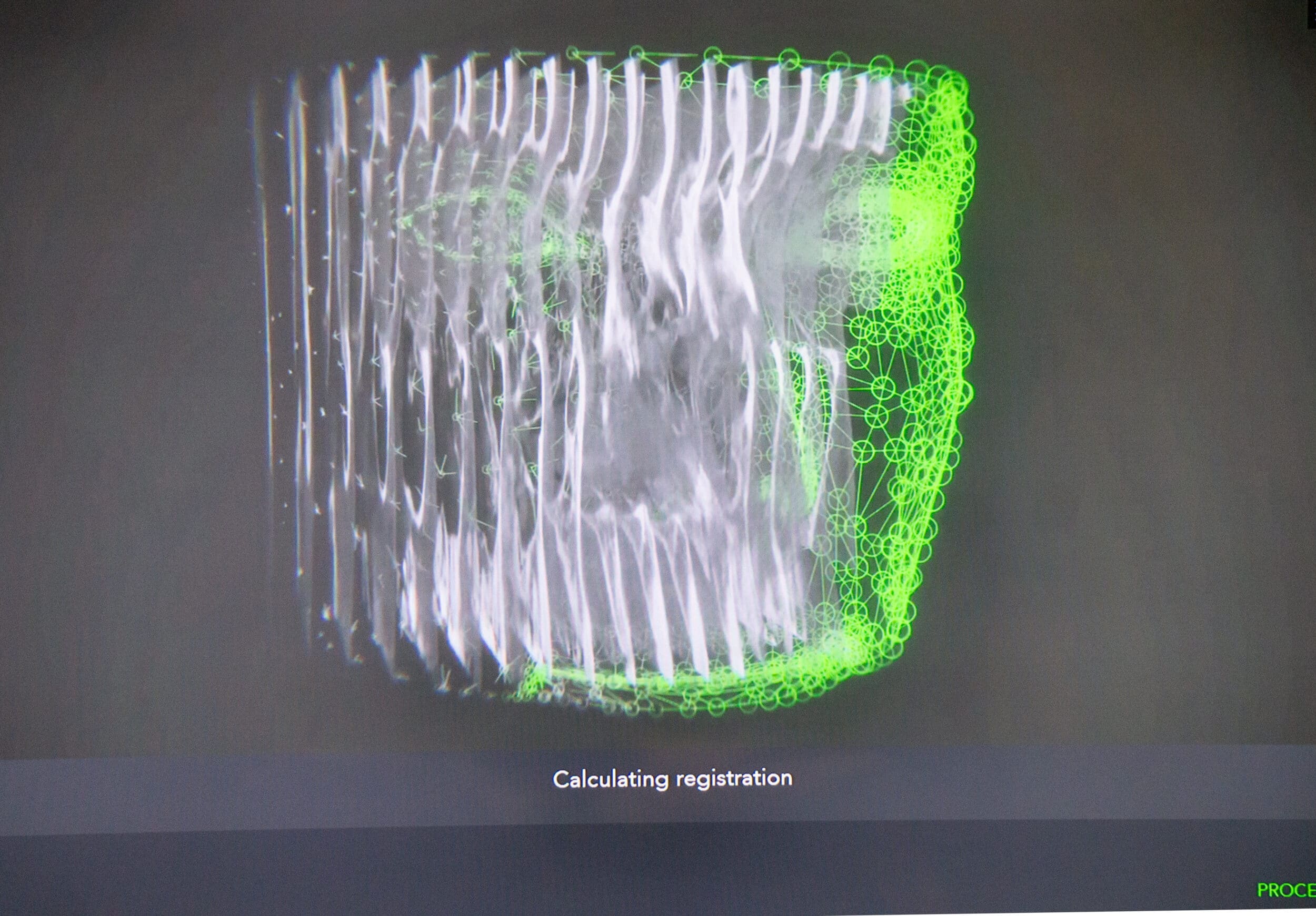 Image Guided Sinus Surgery Las Vegas NV
