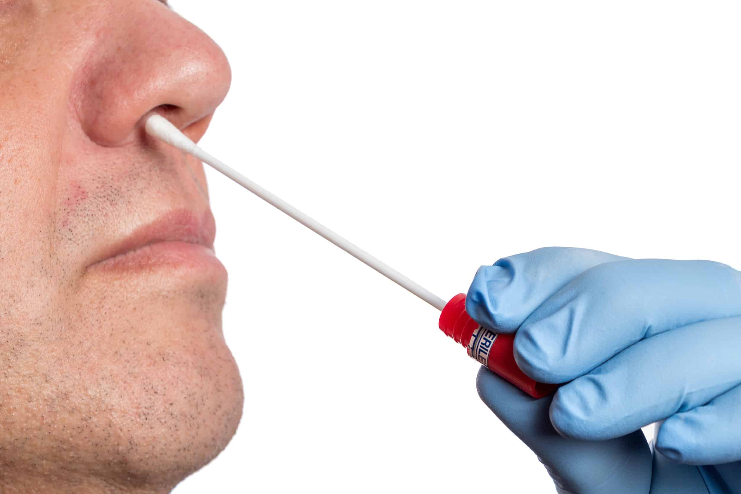 Sinus Cultures & Tests Las Vegas NV Sinus Cultures & Tests Las Vegas NV